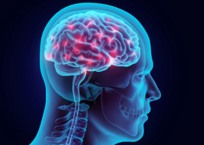 Azúcar cerebro 5.jpg AA
